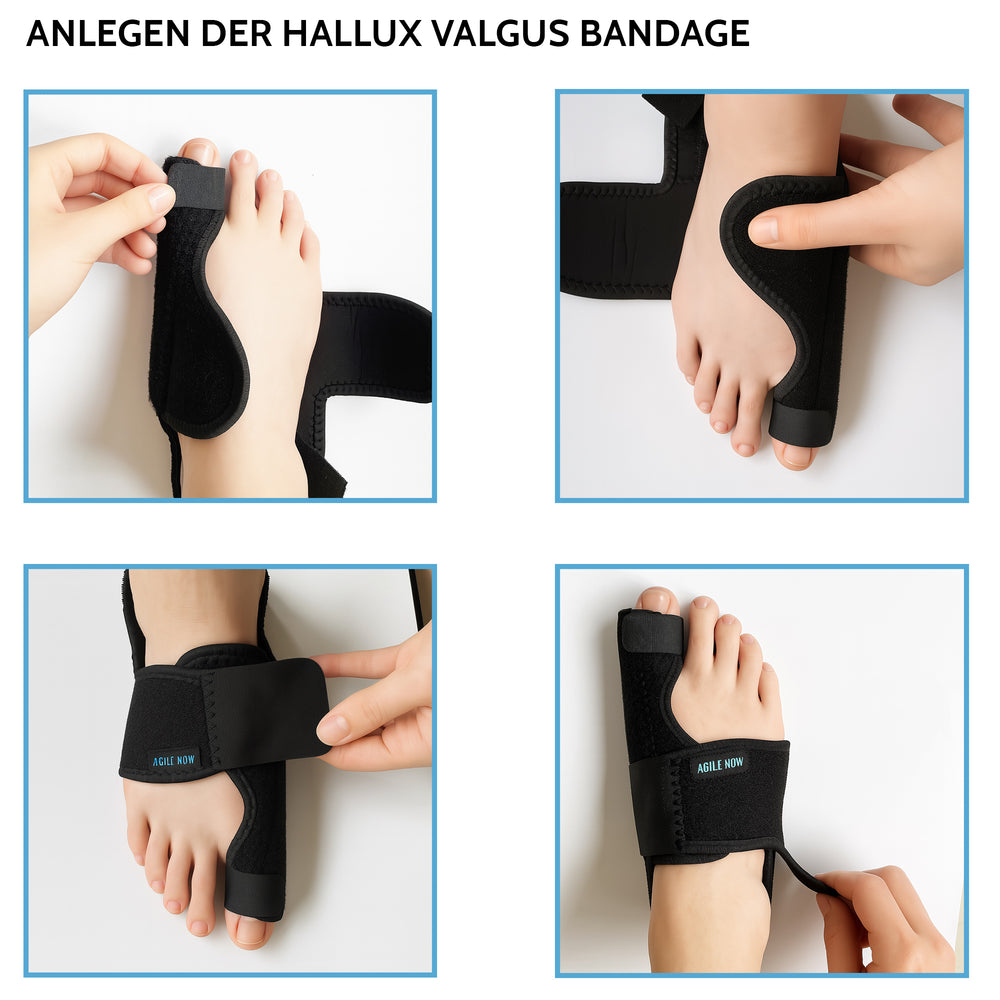 
                      
                        AGILE NOW Hallux Valgus Korrektur
                      
                    